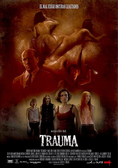 Trauma