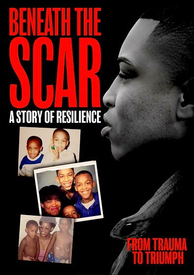 Beneath the Scar: A Story of Resilience